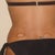 back/flanks 4 days post op