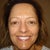 Pre-surgery front view