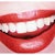 These are NOT my teeth.  I need this picture posted to show this is how I want my teeth.  Widely separated, and my front teeth inside the neighboring teeth, not on them.  And I love front teeth to be longer in front.  I will not be happy until they move a lot.