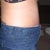 3 weeks, side view, can't wait to see reults once the swelling actually goes down!