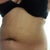 Front tummy view 3-8-13