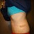 6 Days PO side view