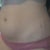 up close to show stretch marks
