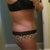 6 week side, you can see how low the swelling is all below my BB