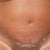 Close up of scar Day 16