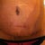 front photo close up on belly button 
almost 4 weeks