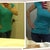 Same shirt, lighting makes the color off morning of explant with the boobs vs day 5 since explant