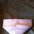 Triangle pad doctor requires me to wear on lower back to reduce swelling and create scoop back