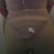 Triangle pad doctor requires me to wear on lower back to reduce swelling and create scoop back