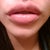 Immediately after injections. 