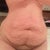 My belly two years after having my twins! Blah
