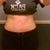 Front with clothes 6 weeks post op.. I couldn't put these on prior to surgery. I have moderate lower belly swelling.