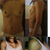 top left: before 32 AA I believe. top right: side view with little projection. bottom left: day of surgery 425 cc high profile silicon under the muscle breast fold incision.  Happy with my results can't wait for them to drop.  I'll upload no-bra shots tomorrow if I can.