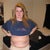 two weeks after smart lipo