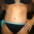 41 days PO.  Hard to believe that this will look even better at 6 months! Happy Happy Happy!