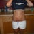 1 week post op
