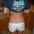 1 week post op