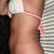 4.5 weeks post op