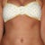 4 months post op