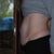 Before Tummy Tuck Side shot