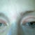 Five weeks.  Have some knotting of the scars and webbing in corners.