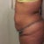Sideview before 1/28/13