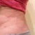 4 months still with bad results