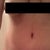 almost 4 weeks post op.  still very swollen but things looking good.