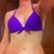 Front 6 weeks Post-op