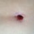 2 months po belly button
