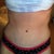 2 months PO front