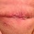 Yucky, but I am sure it will get better! 26 days PO