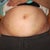 2 days out SWOLLEN
