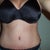 This was taken after my tt/but you can still get an idea of how out of proportion they are...