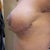 2 months PO