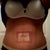 11 days post op