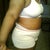 5days post opt