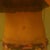 18 weeks scar