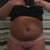 Before surgery