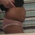 Before surgery