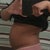 Before surgery