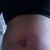 Before surgery