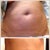 Day 24 before & after. I just wish my skin would shrink!!