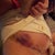 New bruise
Looks bad but not really painful.