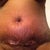 incision started to open up.