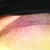 My scar at 8 weeks sooooo light and thin. Love it!!
