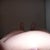 Day 59 8 wk 2 days, bulge on tummy and fluid on pubis sticking out