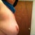 Month and a half post op