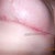 Red & sore from sleeping on my side. ouch! 

ps - please disregard the  little bit of armpit hair, apparently I should start wearing my glasses in the shower. geesh