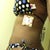 L side scar and stretch marks